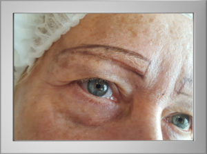 Microblading Norwich before 