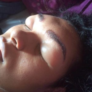 eyebrow-tint-allergic-reaction