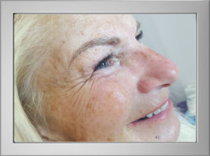 Microblading Norfolk before Caroline K