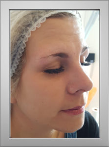 Microblading before Jo K