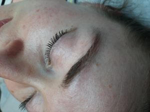 Eyebrow Lamination Before Treatment